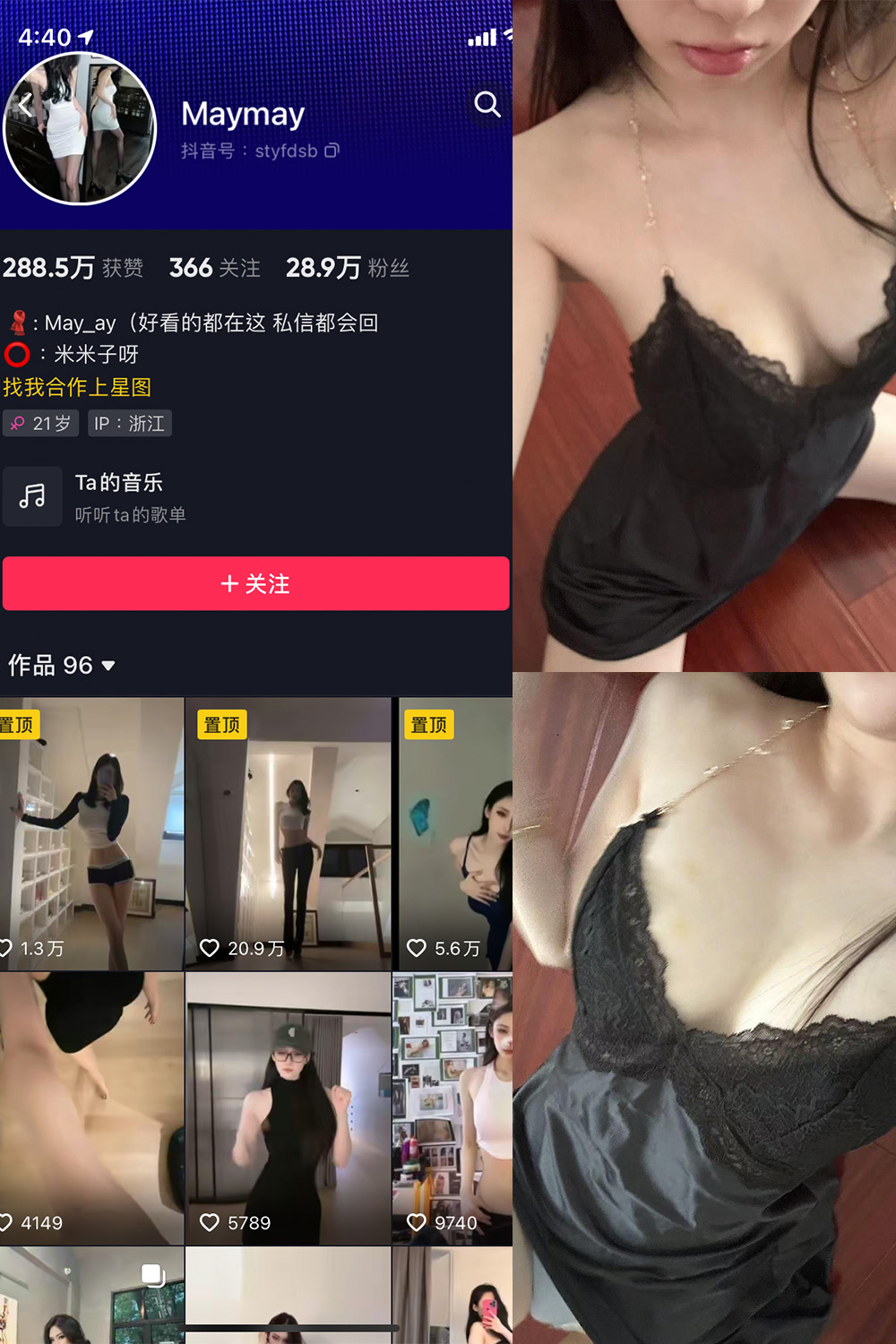 图片[1]-抖音 米米子呀 微密圈 NO.008期 【7P4V】最新至：2023.7.27-微密空间-全网最全抖音网红铁粉空间觅圈